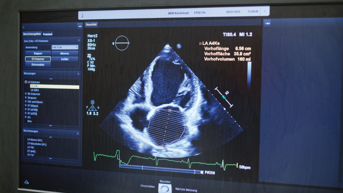 Sonographie Sonographie