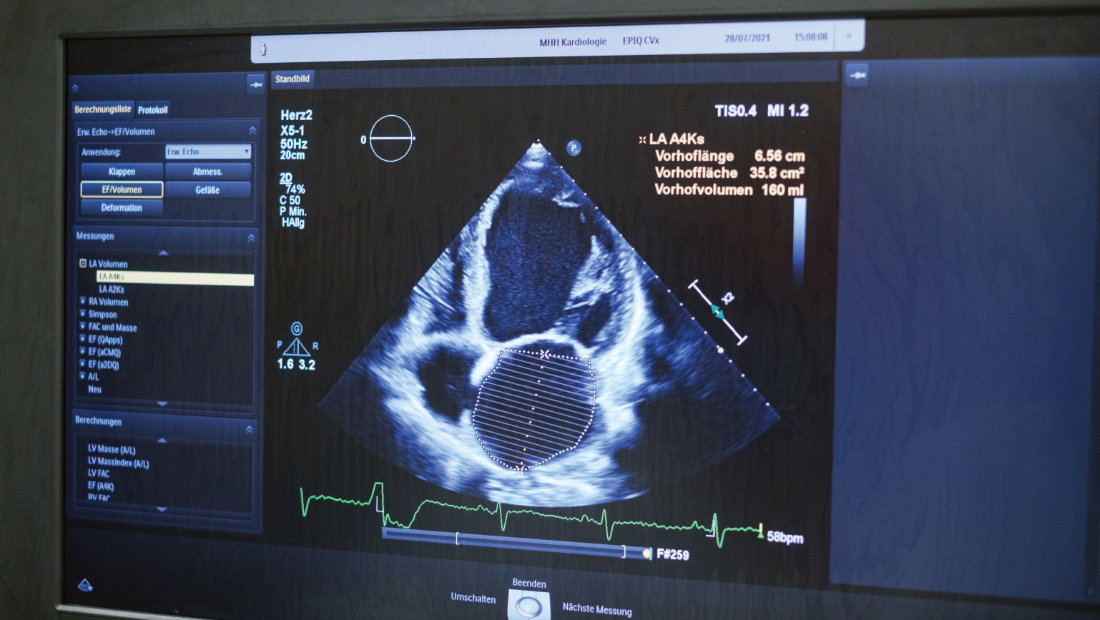 Sonographie